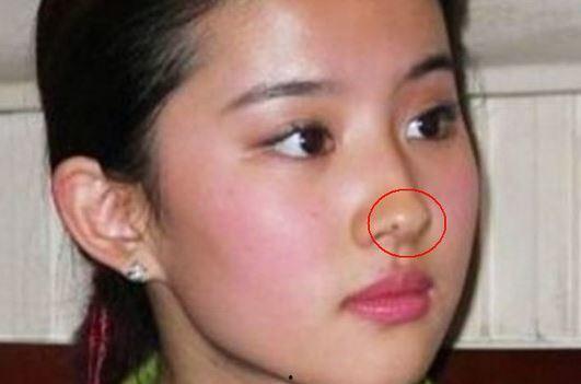 脸上小痣明星,揭秘明星脸上小痣的独特魅力
